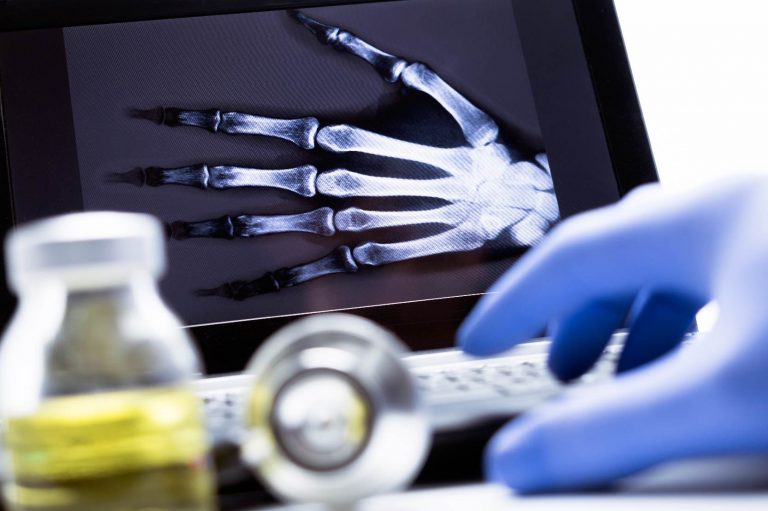 X-Rays & Lab Testing - Norfolk, VA | East Beach Urgent Care | X-Rays ...